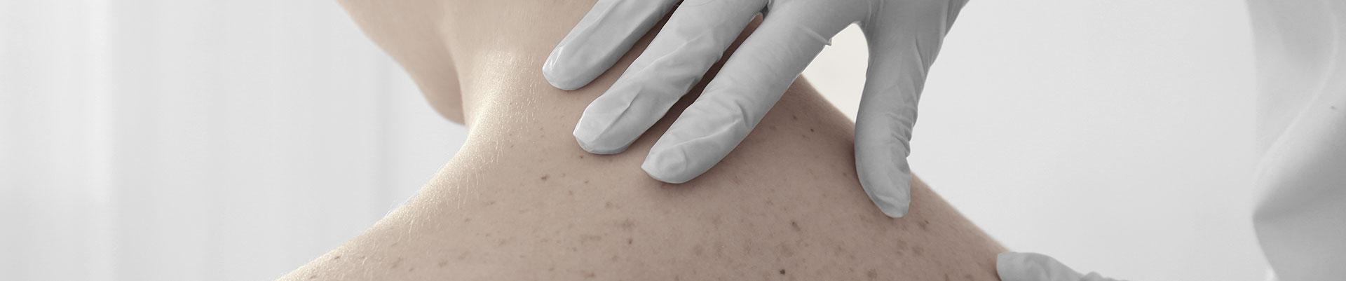 Mãos de médico analisando pintas nas costas de paciente